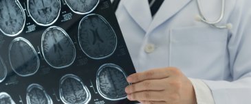 neurologia